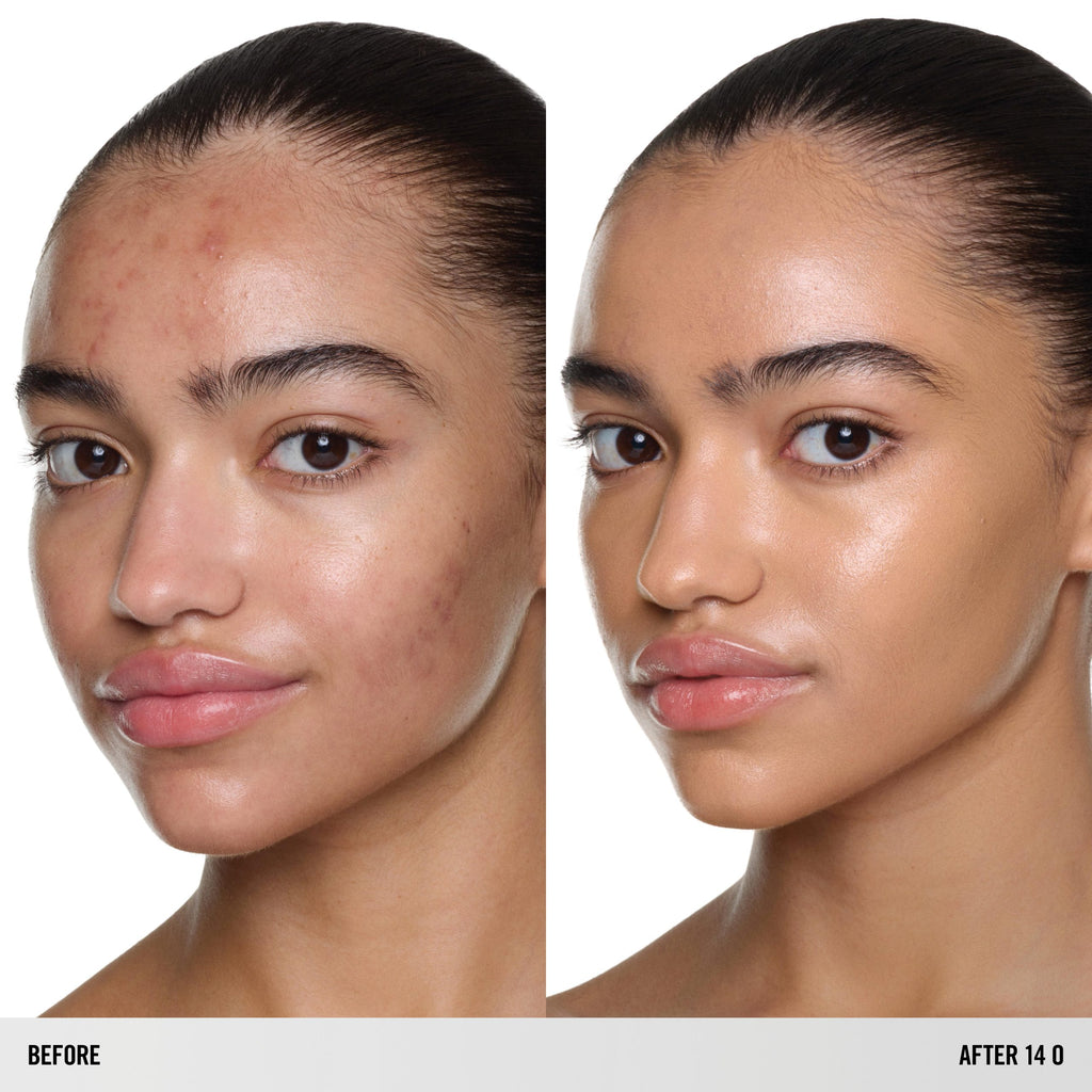 SURREALSKIN FOUNDATION – SurrealSkin Foundation – 14 O