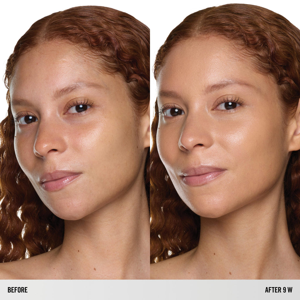 SURREALSKIN FOUNDATION – SurrealSkin Foundation – 9 W