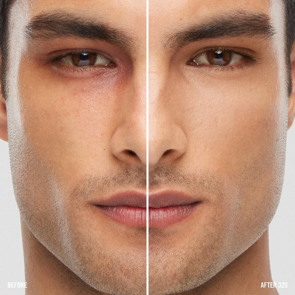SURREALSKIN AWAKENING CONCEALER – SurrealSkin Awakening Concealer – 320 (Medium Peach)